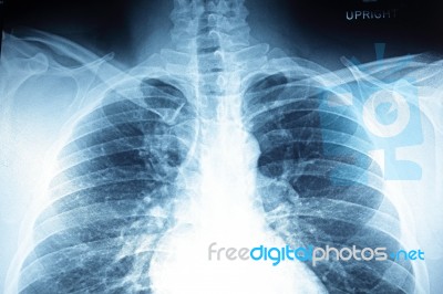 Close Up X-ray Film Stock Photo