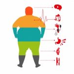 Obesity Related Diseases ,man Health Info Graphic. Fat And Health Man Stock Photo