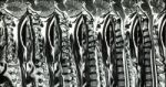 Cervical Spondylosis With Disc Herniation ( Mri Of Cervical Spine : Show Cervical Spondylosis With Disc Herniation Compress Spinal Cord ( Myelopathy ) ) Stock Photo