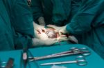 Cesarean Section Stock Photo