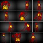 3d Rendering Medical Illustration Of The Human Lung Stock Photo