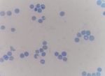 Reticulocyte Stock Photo