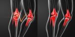 3d Rendering Human Knee Pain With The Anatomy Of A Skeleton Leg Stock Photo