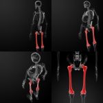 3d Rendering Illustration Of The Femur Stock Photo