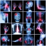 Collection X-ray Multiple Part Of Human And Arthritis,multiple Disease (gout , Rheumatoid,congenital Heart Disease,stroke) Stock Photo