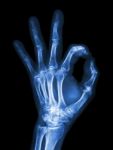 X-ray Hand With Ok Symbol Stock Photo
