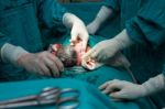 Cesarean Section Stock Photo