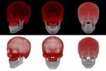 3d Render Medical Illustration Of The Upper Skull Stock Photo