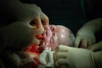 New Born Infant In The Operation Room Stock Photo