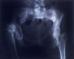 X-ray Stock Photo