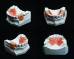 Dentures Stock Photo