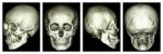 Ct Scan Of Human Skull And 3d Stock Photo