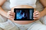 Pregnant Woman Holding Ultrasound Scan On Her Tummy Stock Photo