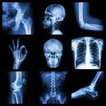 Collection X-ray Part Of Human Stock Photo