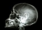 X-ray Asian Skull And Cervical Spine Stock Photo