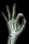 X-ray Hand With Ok Symbol Stock Photo