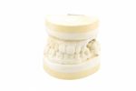 Dental Prosthesis Study Model On White Stock Photo