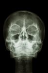 Normal Human's Skull And Cervical Spine Stock Photo