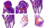 3d Rendering Medical Illustration Of The Metacarpal Bone Stock Photo