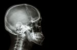 X-ray Asian Skull (thai People) And Blank Area At Right Side Stock Photo