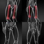 3d Rendering Of The Femur Stock Photo