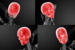 3d Rendering Skull X-rays Stock Photo