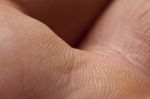 Human Skin Stock Photo