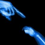 X-ray Adult's Hand Point Finger At Upper Side And Baby's Hand At Lower Side Stock Photo