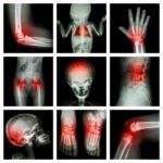 Collection X-ray Part Of Child And Multiple Injury Stock Photo