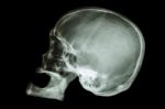 Old Aged Asian's Skull (thai People) , (no Tooth) Stock Photo