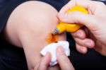 Close Up Wound On Child Leg Stock Photo