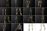 3d Rendering Medical Illustration Of The Tibia Bone Stock Photo