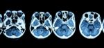 Ct Scan Of Brain And Base Of Skull ( Show Structure Of Eye , Ethmoid Sinus , Cerebellum , Cerebrum, Etc ) Stock Photo