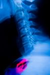 Imaging Of Spinal Column Stock Photo