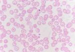 Red Blood Cells With White Blood Cells Background Stock Photo