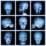 Collection Of Asian Skull Stock Photo