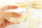 Mold Colonies In Petri Dish Stock Photo