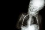 X-ray Body Of Child And Blank Area At Left Side Stock Photo