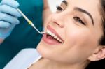 Dental Treatment Of Female Stock Photo