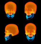 3d Rendering Of Human Skull Upper Half Stock Photo