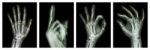 Collection X-ray Symbol Hands Stock Photo