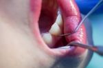 Young Girl Having Dental Check Up Stock Photo