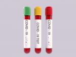 3d Illustration Of A Covid 19 Blood Sample Tube  Stock Photo