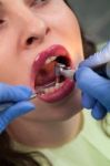 Young Girl Having Dental Check Up Stock Photo