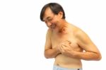 "myocadial Infarction" (ischemic Heart Disease) Stock Photo