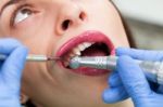 Close-up Medical Dentist Procedure Of Teeth Polish Stock Photo