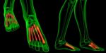 3d Rendering Medical Illustration Of The Metatarsal Bones Stock Photo