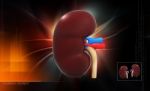 Human Kidney Stock Photo