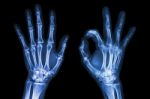 X-ray Both Hands With Ok Sign Stock Photo