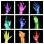 Collection Of Colorful X-ray Hands Stock Photo